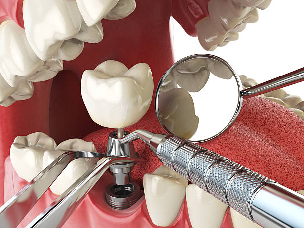Best 24-Hour Emergency Dentist in Great Falls Crossing, VA